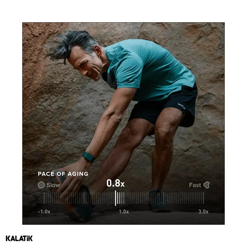 مچ بند هوشمند ووپ مدل Peak